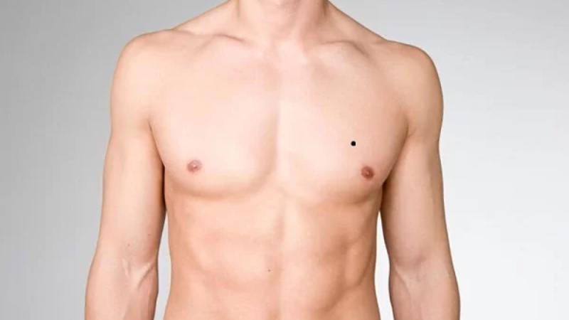 Giải mã nốt ruồi ở ngực nam giới có ý nghĩa gì