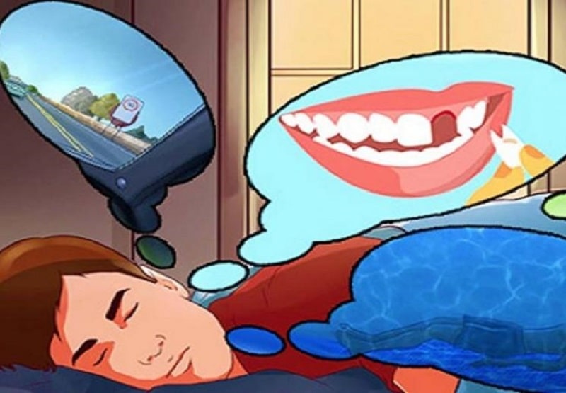 Ngủ mơ gãy răng do đâu? Là điềm tốt hay xấu?