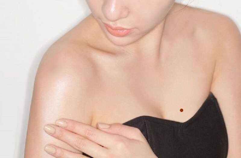 Nốt ruồi ở ngực mang ý nghĩa gì 