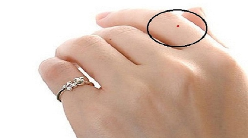Nốt ruồi trên ngón trỏ tay trái/ phải có ý nghĩa gì?