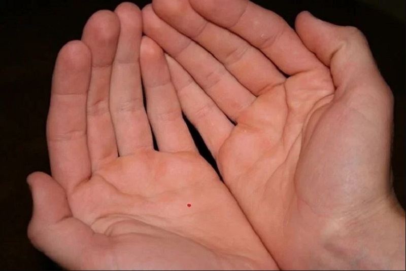 Một số vị trí nốt ruồi son phú quý trong lòng bàn tay